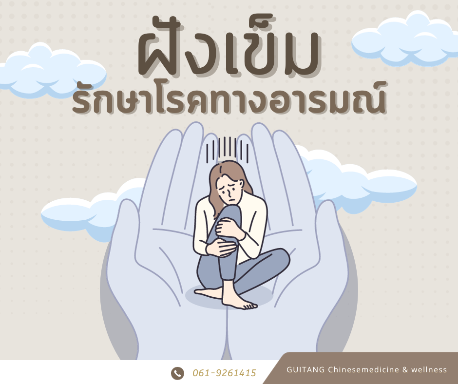 จุดฝังเข็มรักษาโรคทางอารมณ์