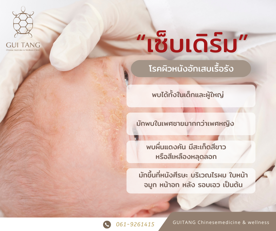 โรคเซ็บเดิร์ม(Seborrheic Dermatitis) 