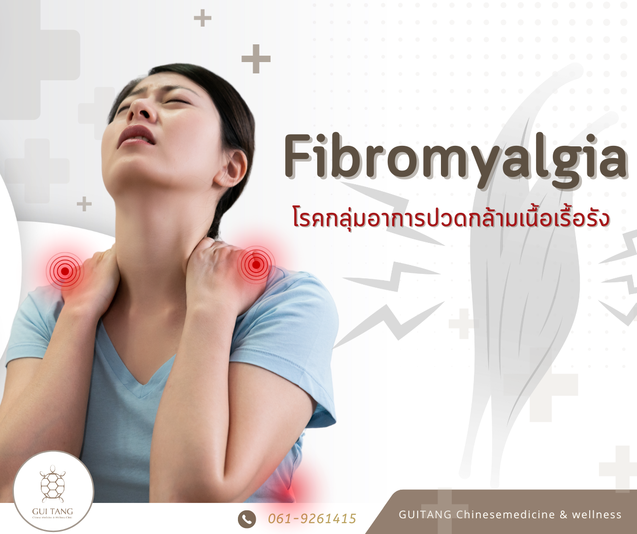 ไฟโบรมัยอัลเจีย (Fibromyalgia)