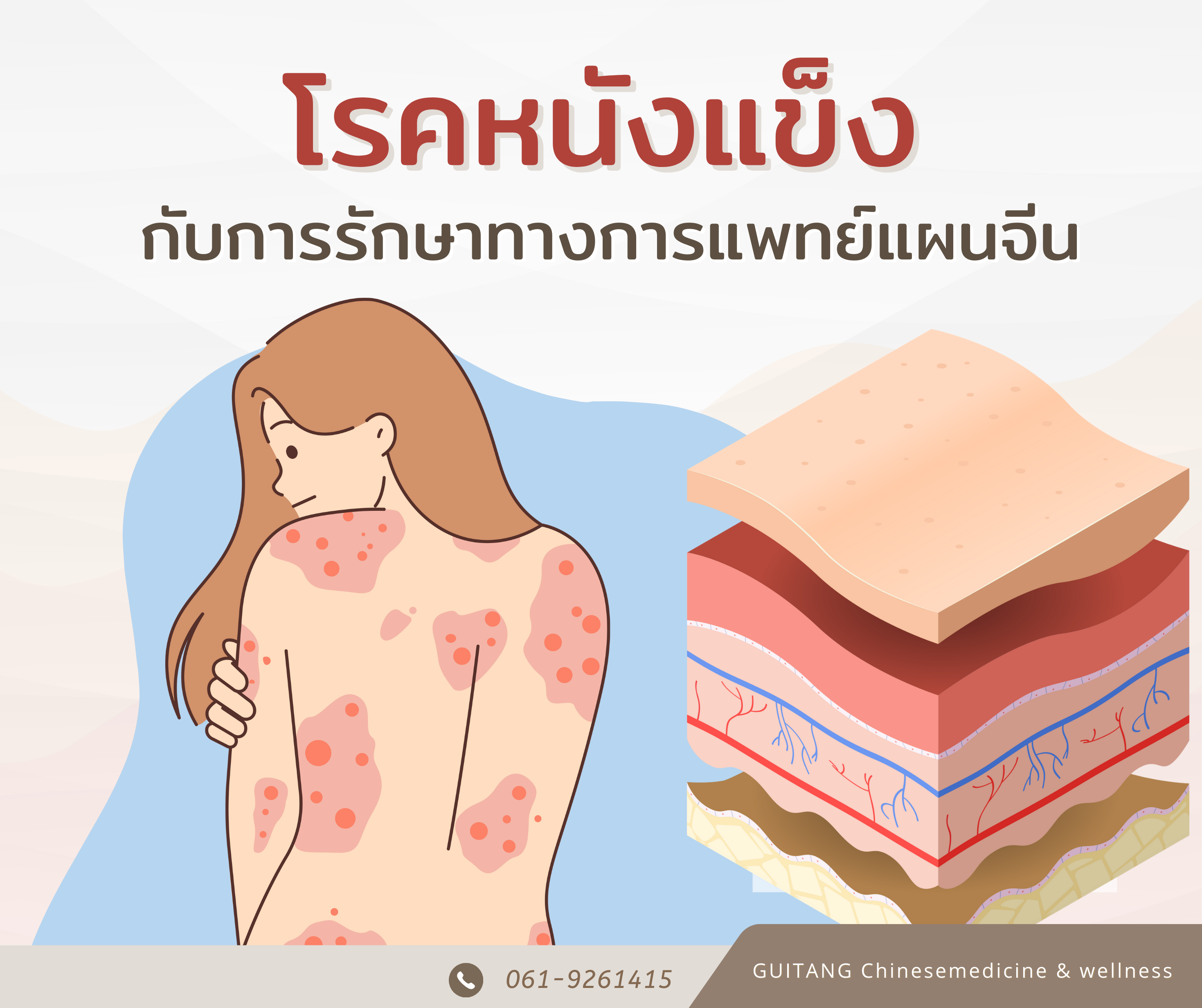 แผนจีนรักษาโรคหนังแข็งได้อย่างไร