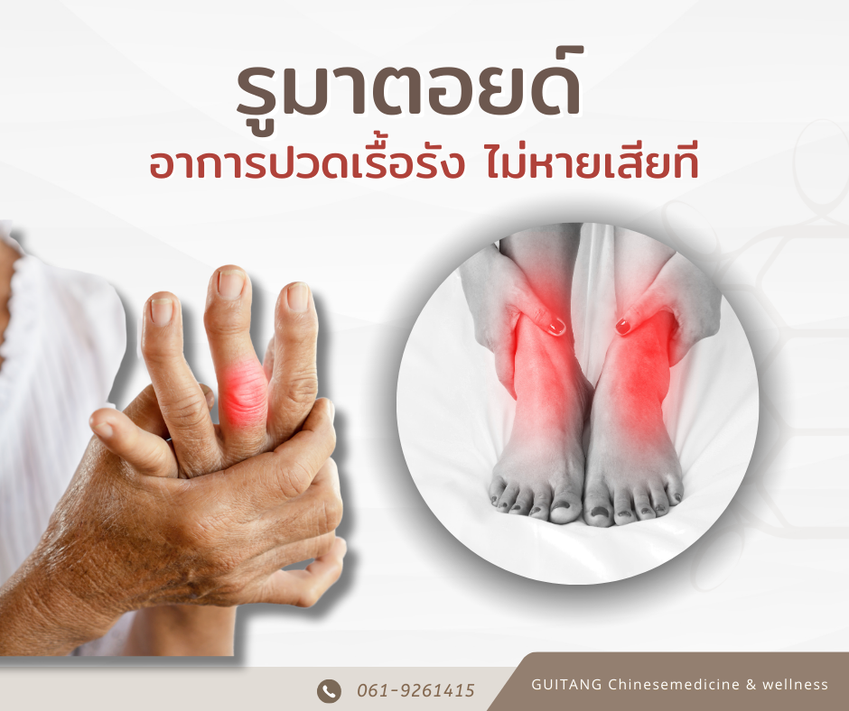 รูมาตอยด์ (Rheumatoid Arthritis)